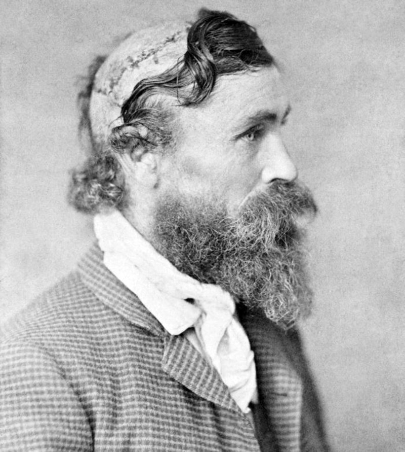 010 - Robert Gee scalped by sieox chief little tutle 1864