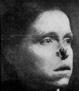 04 - Radium Girls 1a